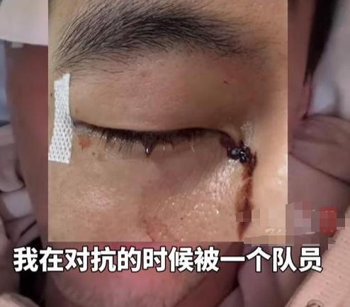包含篮球名将受伤重创，全球球迷为之惋惜的词条